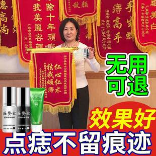 点痣的药膏祛痣去痣无痕，古法痦子肉痣去除脸部，黑点药水神器