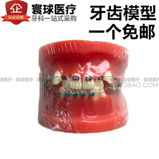 牙科模型正畸矫正半金属，半陶瓷模型医患，沟通教学模型牙科