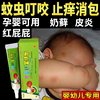 婴儿湿疹专用儿童奶藓膏口水疹婴幼儿热疹宝宝霜皮肤止痒止痒止痒