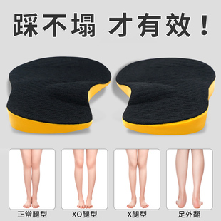日本o型腿矫正鞋垫儿童成人，xo足外内翻内外八字脚，纠正器直腿神器