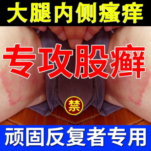 股藓大腿内侧瘙痒湿疹止痒真菌感染股癣专用屁股牛皮癣股廯yao膏