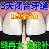 牙缝宽大修复神器补牙缝牙膏填充门牙牙缝大矫正防堵蛀牙牙洞清理
