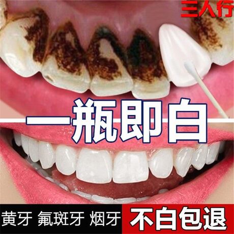 去黄牙黑牙烟牙渍