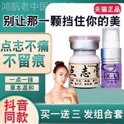 点痣膏无痕净痣膏祛膏药水，美容专用去痣斑痣，清黑点除志