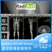 radiantdicomviewer2023中文版，dcm医学ct影像查看软件，永久激活