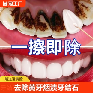 洗牙粉去黄洗白去黄牙，美白速效黄牙洗牙齿，污垢除牙石烟渍牙垢神器