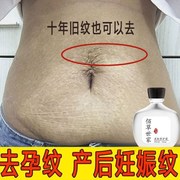 去妊娠纹肚子妊辰纹产后消除大腿肥胖纹生长纹预防紧致产后修复.