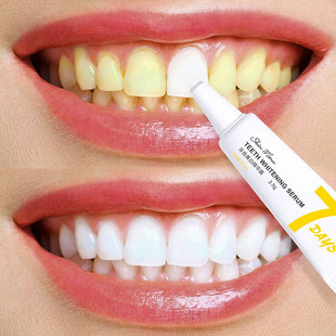 牙齿美白 速效 黄牙牙黄去黄神器焕颜精华牙渍牙垢去除器一擦即白