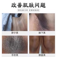 腋下去黑磨砂膏关节手部胳肢窝，身体嫩白全身，非美白膝盖去黑角质膏