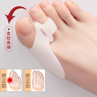 大脚趾矫正器分趾器大母，脚趾头足纠正可以穿鞋男女士拇指外翻矫正