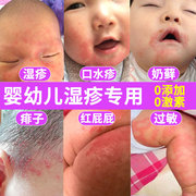 湿疹婴儿专用宝宝湿疹膏口水疹，脸部红屁屁，过敏外用止痒紫草油膏