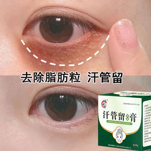 祛去除脂肪粒油脂粒眼部面，脸部淡化眼袋黑眼圈，专用膏汗管瘤眼霜4