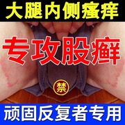 股藓大腿内侧皮肤瘙痒真菌感染体股癣非专用去湿疹屁股止痒薬膏根