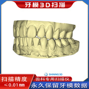 3d扫描牙模获取石膏牙齿，三维数据保存定制牙齿保持器夜磨牙套