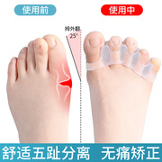 脚趾矫正器大脚趾拇指外翻纠正神器，脚趾重叠分趾器男女士可以穿鞋