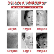 红血丝修复去除脸部角质层薄修复敏感肌肤泛红淡化大红脸专用面霜