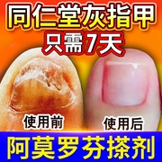 阿莫罗芬搽剂灰指甲，治療专用修复脱甲膏真菌，感染抑菌液