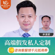 韩艺家假发男短发真发整顶发套头顶补发片真人，发丝男士假发套定制