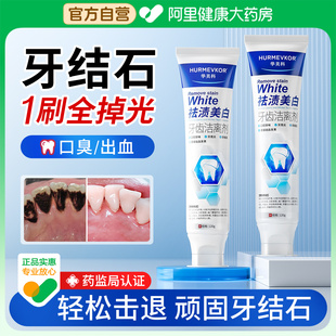 牙结石牙膏专用洗牙齿污垢牙石去溶解牙渍去除器牙垢黄牙神器除