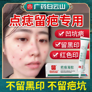 点痣去疤痕修复膏去痘印疤印脸上黑色素沉着沉淀祛痣去除痣凹陷性