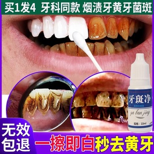 牙斑净牙齿美白速效黄牙去烟渍茶洗污垢除牙石牙菌斑祛除清洁神器