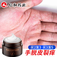 手脱皮修复霜膏季节性，手掌手指干裂手上起皮干燥掉皮足脚严重专用