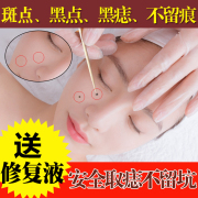 点痣膏无痕药水脸部祛痣祛斑痦子取痣贴去痣，黑痣去除黑点神器