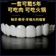 假牙套仿真假牙套吸附可吃饭国产老年人通用补牙缺牙假牙临时假牙