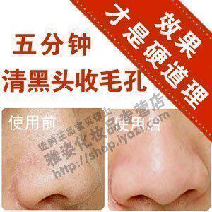 黑头导出液 快速去黑头粉刺白头粉刺 去黑头产品 收毛孔 秒杀