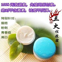 三火祛痘霜 青春痘 暗疮 痤疮 黑头粉刺 上万例患者验证