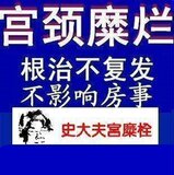 【史大夫宫糜栓】宫颈炎 宫颈糜烂 妇科炎症 纯中药特效 无效包退