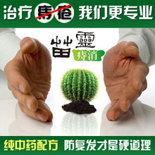 远离手术！内痔外痔混合痔治痔疮脱肛便血肛裂肛瘘息肉痔疮膏中药