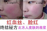 红血丝、脸红终结 增厚角质层 退红极显著